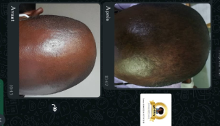 Résultats Avant / Après Shampoing et Duo